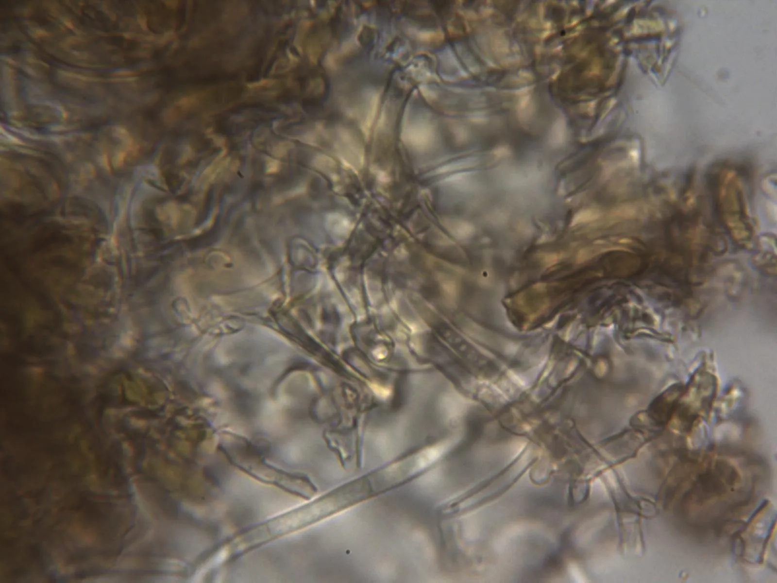 Microscopía de Passalora acanthicola - 10 - Hifas conidiógenas 2